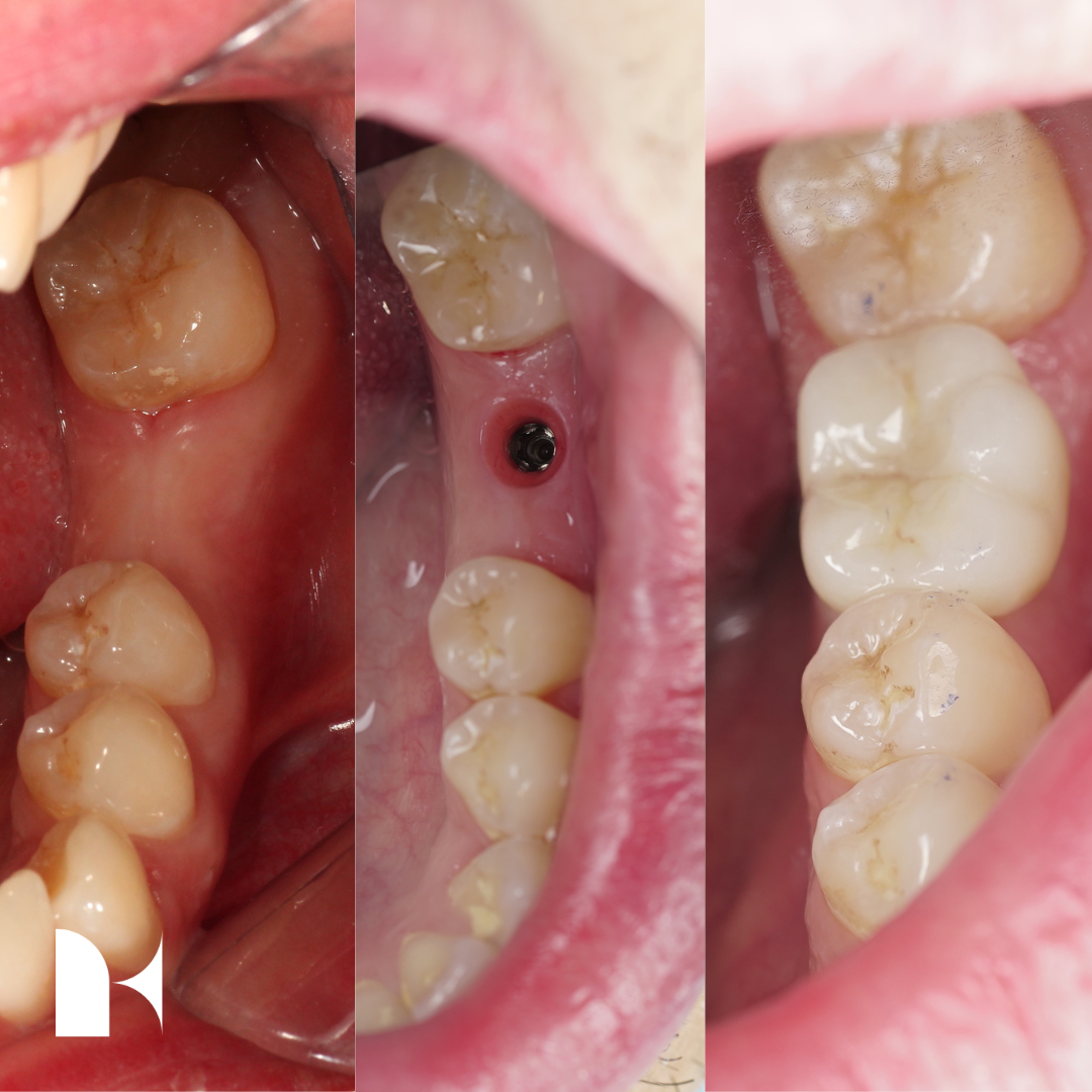 kitadental-case(11)