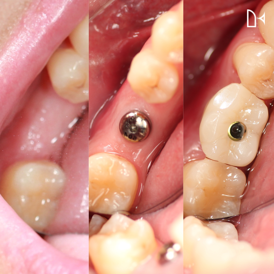 kitadental-case(13)