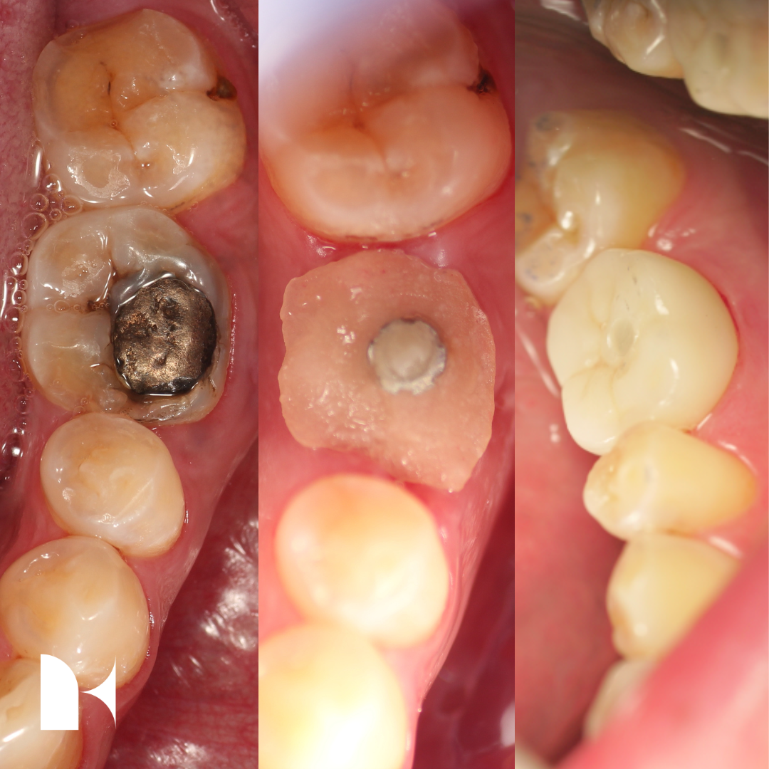 kitadental-case(15)