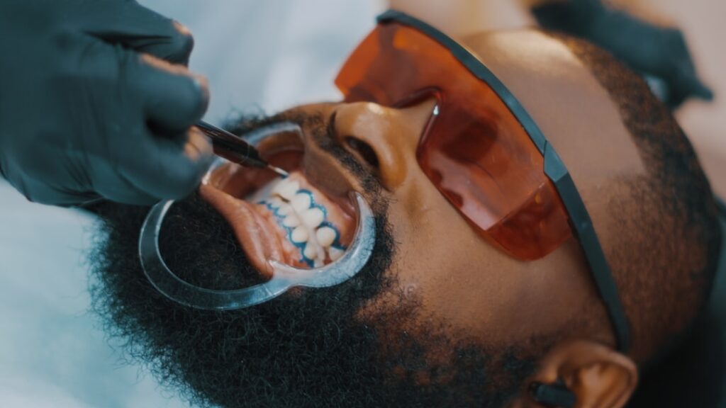 how much does teeth whitening cost sydney