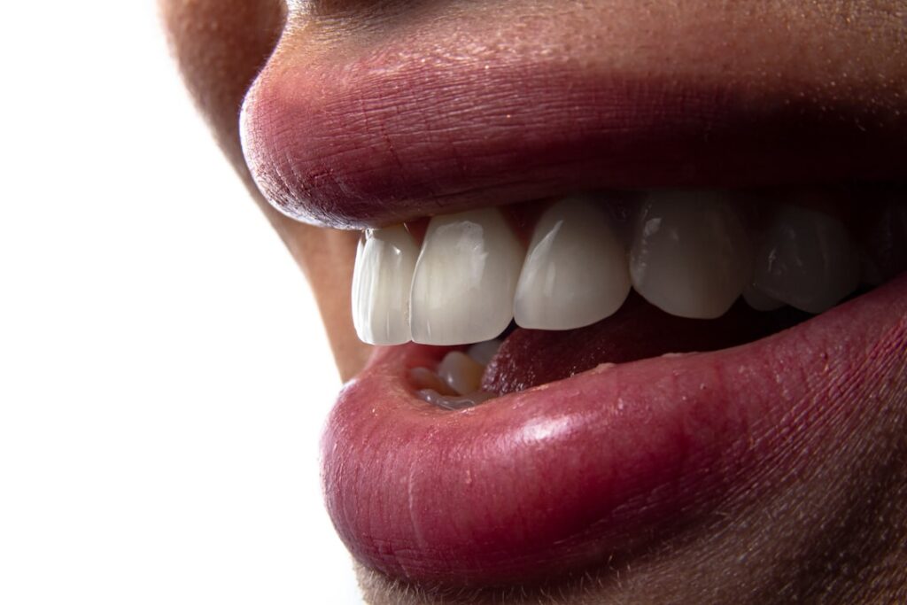 teeth whitening campbelltown