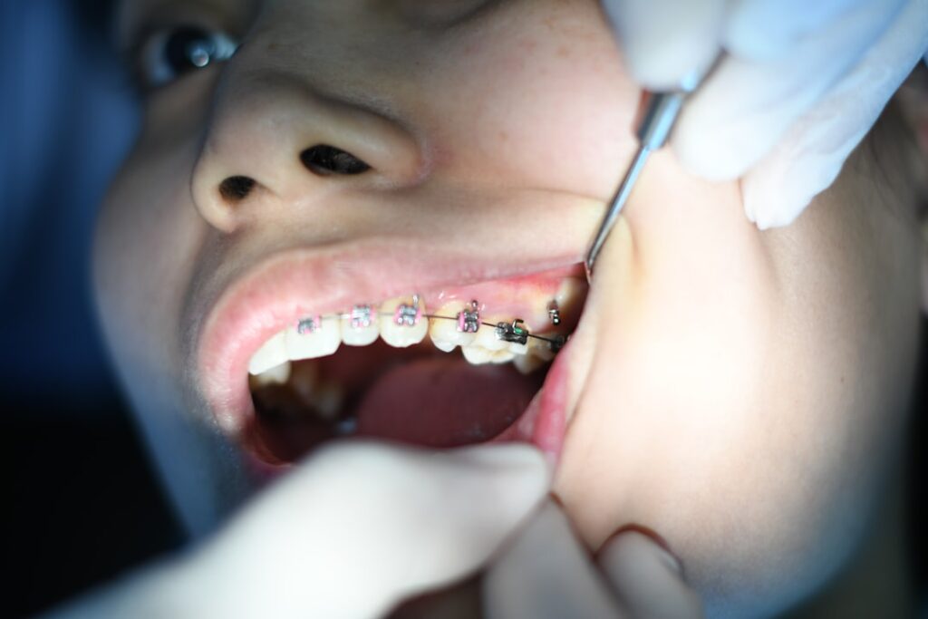 Braces cost Sydney