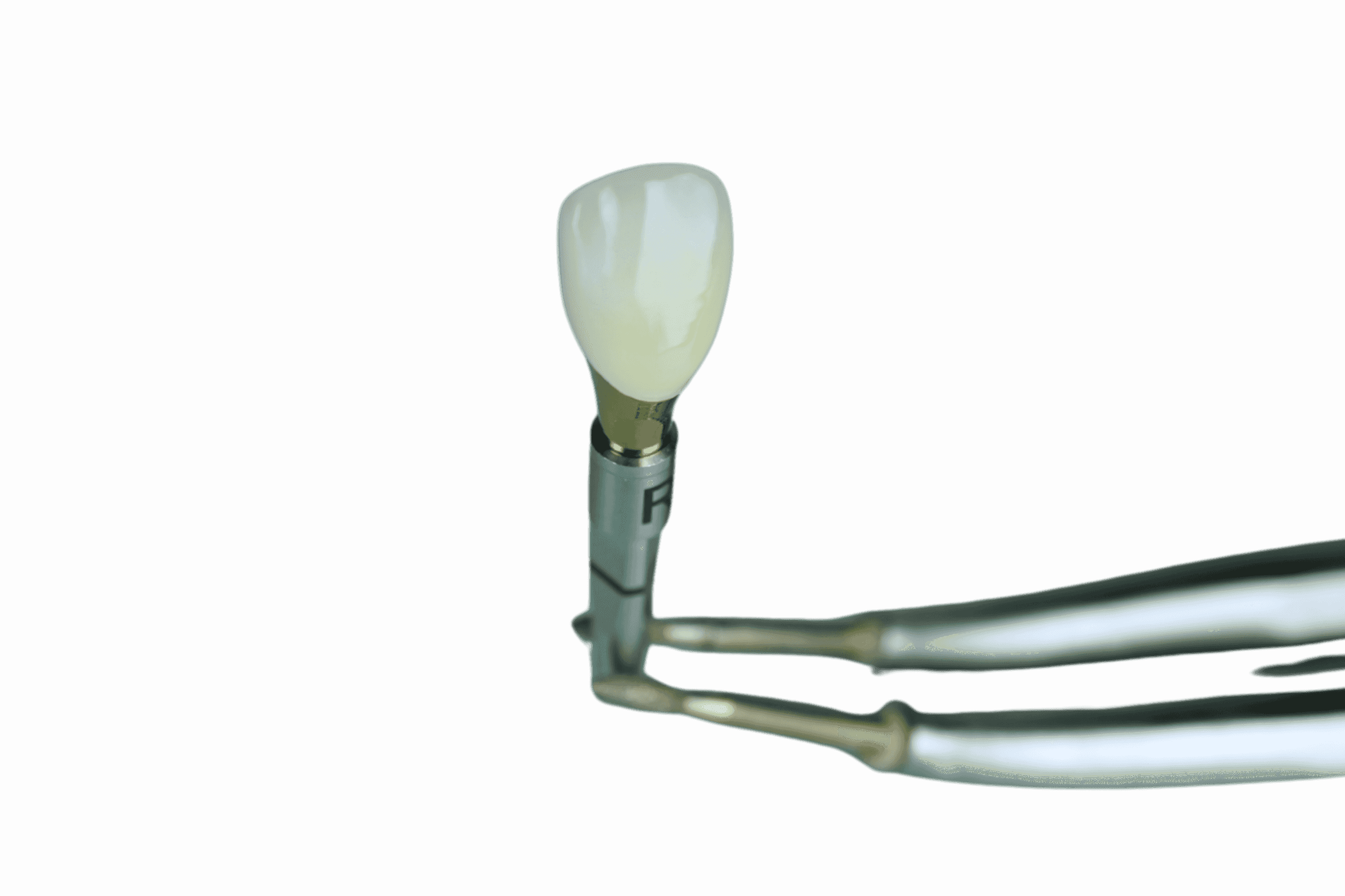 single dental implant