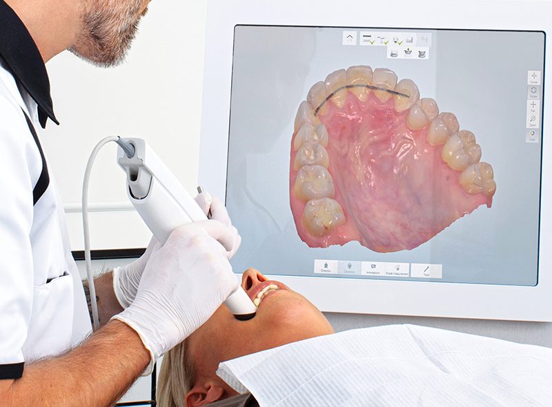 intra oral dental scanner intra oral dental scanner